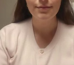Client jawline after ten sessions